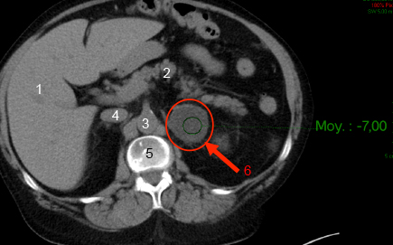 Un scanner médical : à quoi ça sert ? – Jesuisprevoyant